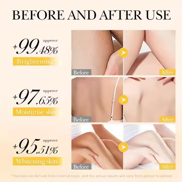 Loción corporal blanqueadora OEM con cúrcuma y VC, anti acné, hidratante, logotipo personalizado