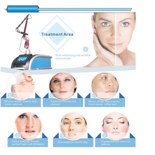 лазер 1064нм 532нм 755нм Пико машины удаления татуировки лазера переключателя к