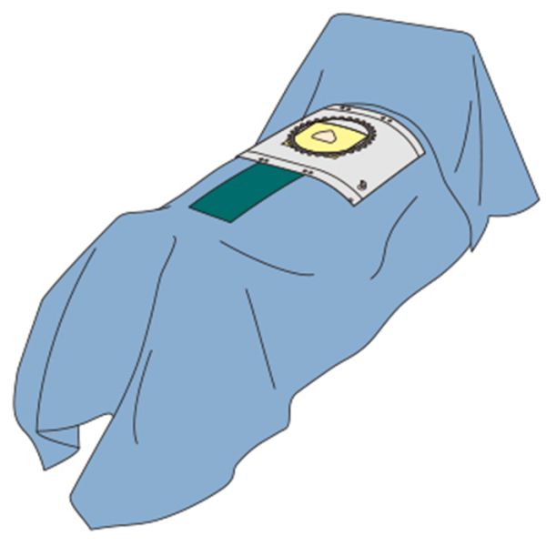 ETO Sterile Dark Blue Disposable Medical Drapes For C Section