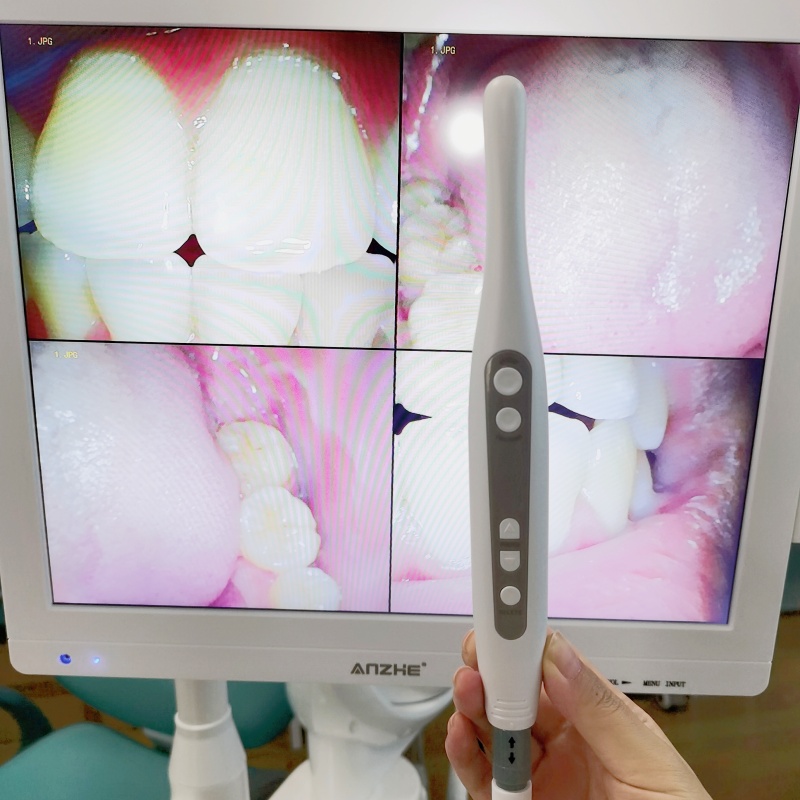 Wifi все в одном оральной камеры с громкоговорителем LCD экран стоматологической оральной камеры сканер