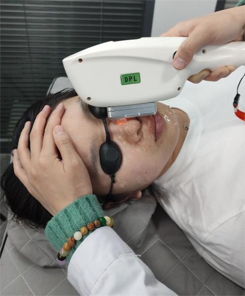 GOMECY IPL Laser Machine SHR OPT Medical CE Approved Sh Ipl Painless Hair Removal