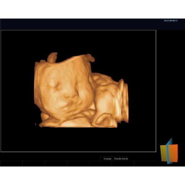 Zoncare 3D/4D Trolley Medical Digital Color Doppler Ultrasound System for Hospital