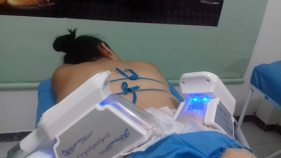 2018 Cryolipolysis Ultrasound Cavitation RF / Europe popular 4 handpieces cryomed cryolipolysis machine cellulite