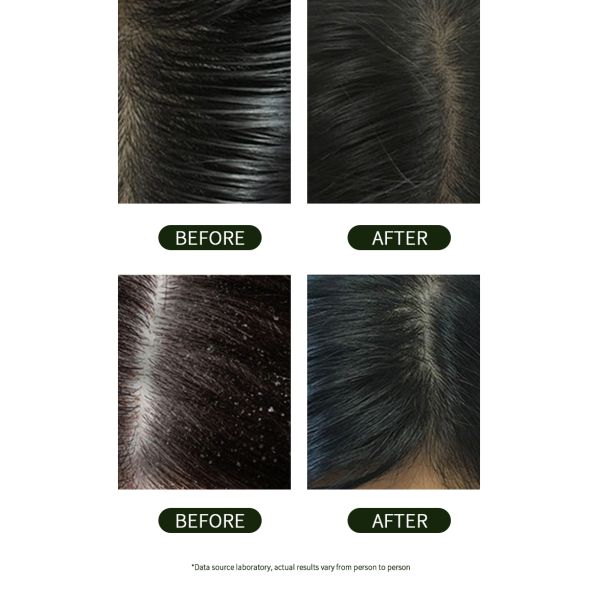 Hydrates And Nourishes Hair And Scalp Long Lasting Fragrance Simply Grow With Activation Shampoo De Rosemary