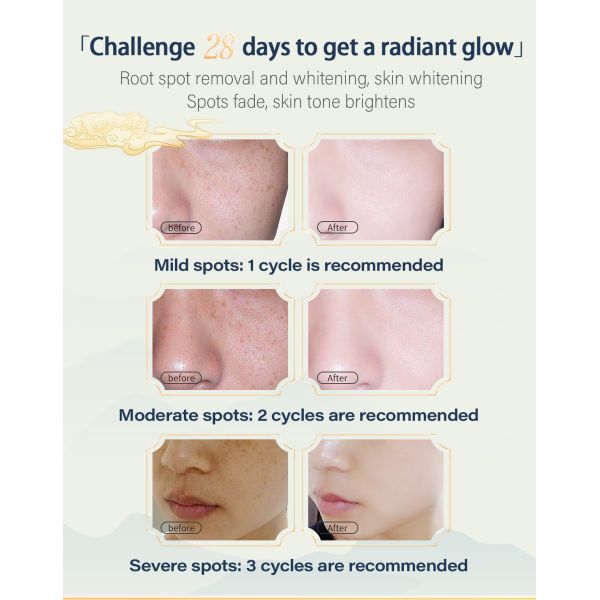 Wholesale Lightening Whitening Anti Freckle Removing Dark Spot Moisturizing Face Melasma Dark Spot Corrector Whitening Cream