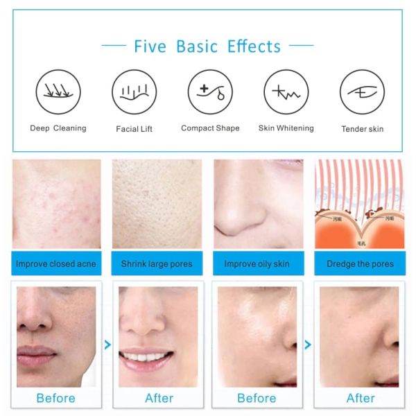 Подмолаживание кожи красоты цветов машины 7 терапией света СИД фотона PDT