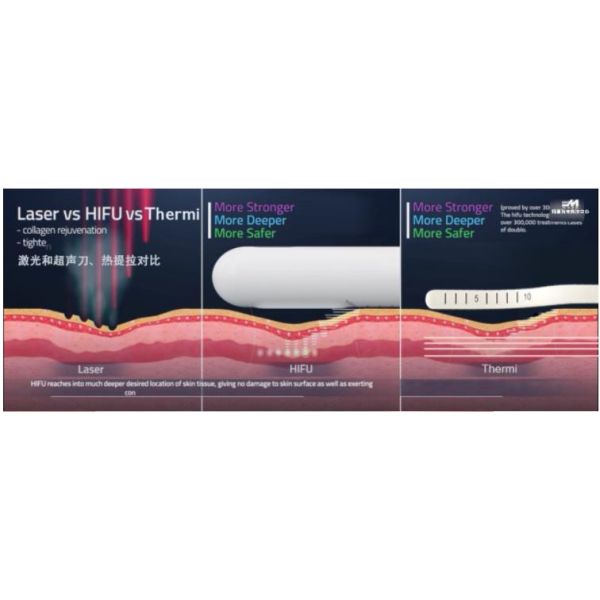 Korean female intimate areal Tighten Labia Tighten Women's Private Area Rejuvenation Anit-aging Radio Frequency RF BIO Stimulating