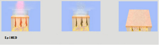 Безболезненная машина удаления волос OPT SHR IPL с светильником ксенона, длиной волны 650 до 950 nm