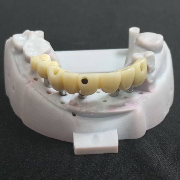 Customized Dental Zirconia Crown Bridge Implant Bar Using 3D Laser Printing