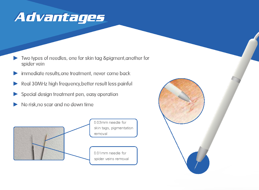 2018 updated spider veins nose treatment rbs vascular machine spider vein removal