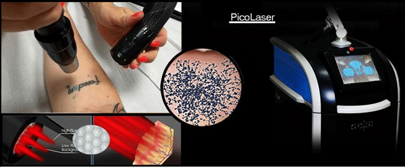 Vertical Laser Skin Rejuvenation Machine 532nm 1064nm 755nm 2-10mm Spot Diameter