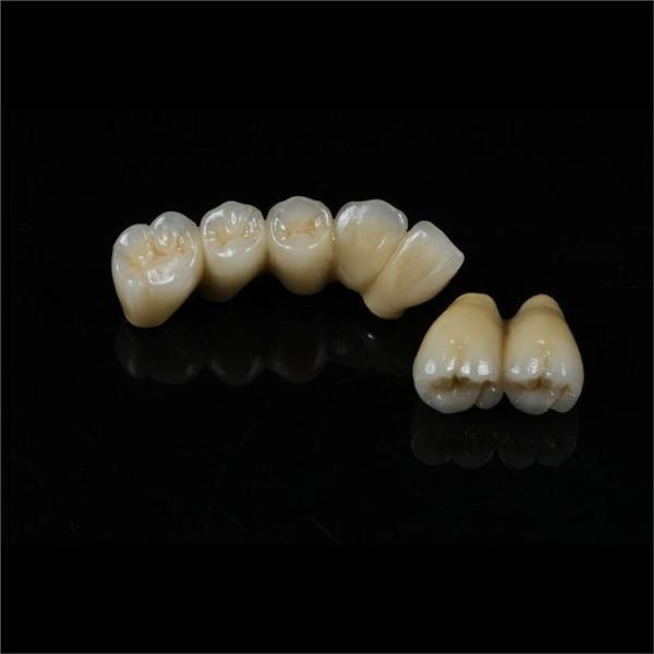 Cad Cam Implant PFM Crown Bridge Dental Medical Grade Adhesive