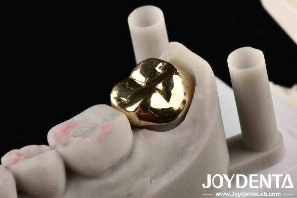 Professional Grade Gold Crown For Dental Oral Clinical Application Yes Abrasive Resistance
