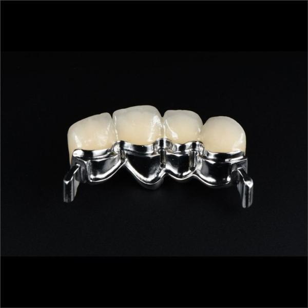 Precision Zirconia PFM Crowns Partial Dentures Natural Looking