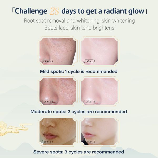 KM Custom Anti-Aging Firming Whitening Freckle Removing Cream Anti-Freckle Acne Moisturizer with Arbutin for Beauty Salon Use