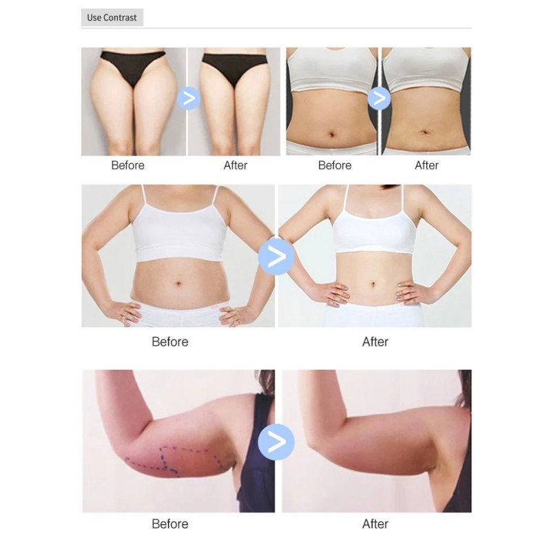 TOP 2026 New Body Shaping Non-Invasive Fat Burning Threapy Beauty Inner Roller Ball Machine Weight Loss Slimming