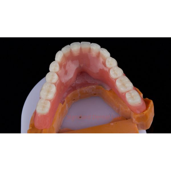 Ivoclar Digital Dental Implant Bar Denture with Attachments Full Acrylic Denture Titanium Implant Supported Dentures