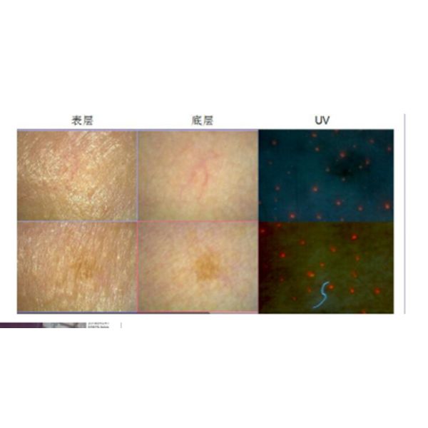 Máquina portátil del escáner del analizador del pelo del analizador de la piel de la belleza