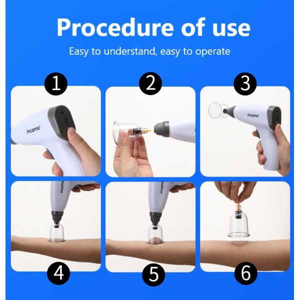 20 Cans Electric Cupping Vacuum Cupping Device Household Set with Massage Equipment Properties Non-cupping Beauty Salon Tool
