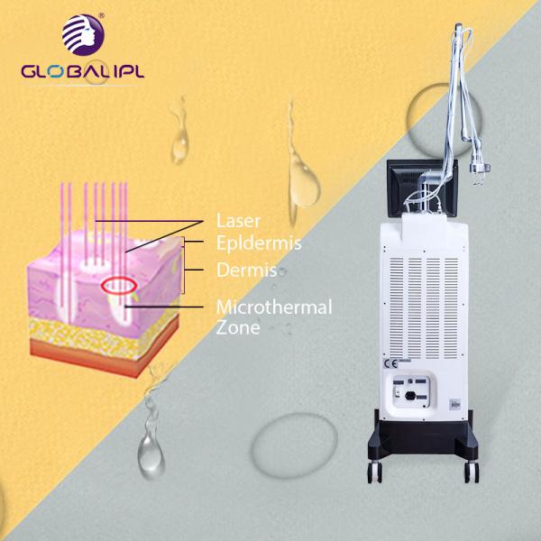 Descasque o poder fracionário da frequência 50W do equipamento 33.3Hz do laser do CO2 do rejuvenescimento