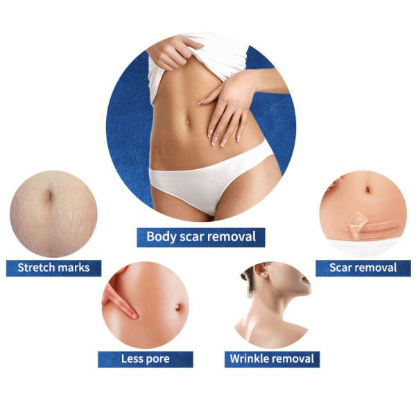 Затягивать кожи машины Microneedling радиочастоты салона 50W