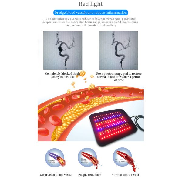 Терапия красного света машины терапией домашней пользы фотодинамическая прокладывает напряжение тока деятельности 12в