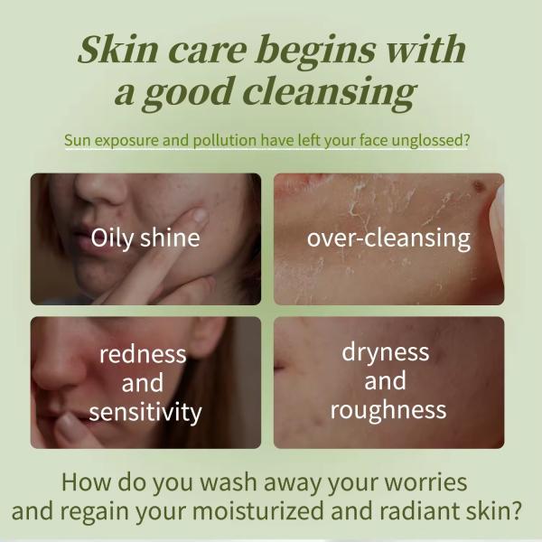 Controle de óleo Refrescar lavagem facial Acne limpeza de aminoácidos Limpeza facial de pele oleosa