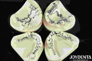 Good Fit Dental Metal Framework Metallic Material For Durable Dental Restoration