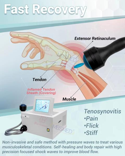 Shock Wave Therapy Ed Shockwave Erectile Dysfunction Focus Shock Wave Pain Relief Eswt Shockwave Therapy Machine