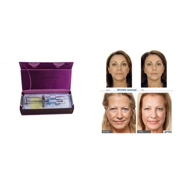 Allergan Juvederm 1ml*2 Hyaluronic Acid Fillers Nose Voluma With Lidocaine