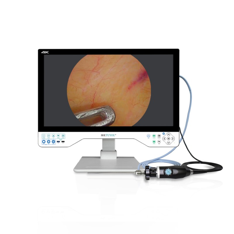 CE ISO13485 Certified 24 Inch UHD 4K Medical Endoscopic Camera System with SONY