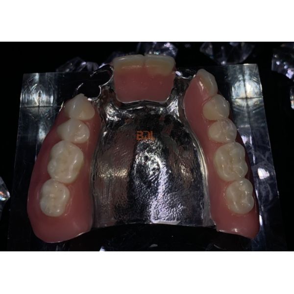 Openresty Server Software Based Metal Framework Partial Dentures Featuring Customizable Fit and Long Lasting Performance