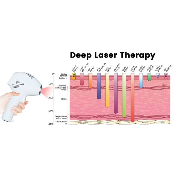 Vertical 1470nm Diode Laser Skin Rejuvenation Laser Machine Professional