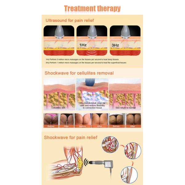 Appareil de thérapie par ondes de choc axées ABS avec mode pulsation / ultrasons continus