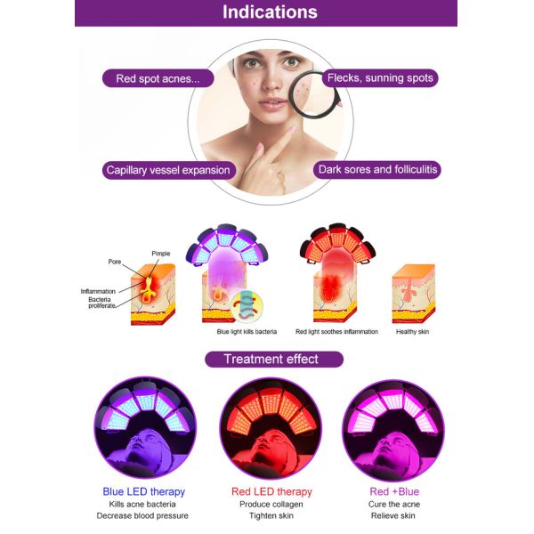 Голубая машина обработки угорь терапией света СИД для подмолаживания кожи