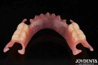 Dental Flexible Dentadura Flexible Con Finish Con Alta Stealth Diversos Materiales