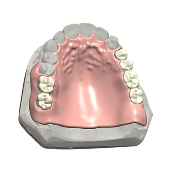 Модель цвета 3D съемного зубоврачебного частично Denture естественная зубоврачебная подгоняла