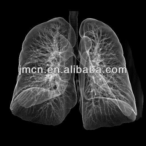 Double Layer DT2B Medical Dry Film X Ray For Agfa Thermal Printer