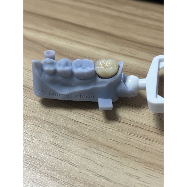 Full Zirconia Crown - High Strength Biocompatible Dental Crown for Durability