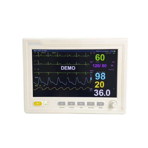 China Manufacturer's Portable 10 Inch Ultra-Thin Patient Monitor Multi-Parameter Bedside Dental Examination Therapy Equipment