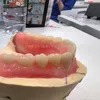 China Dental Lab Digital Full Dentures Using CAD/Cam Technology 3D Printing and Skilled Technicians