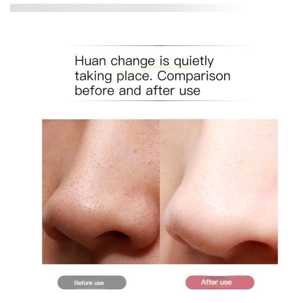 Скруббер перевозчика угорь 300g пластикового портативного ультразвукового скруббера кожи профессиональный