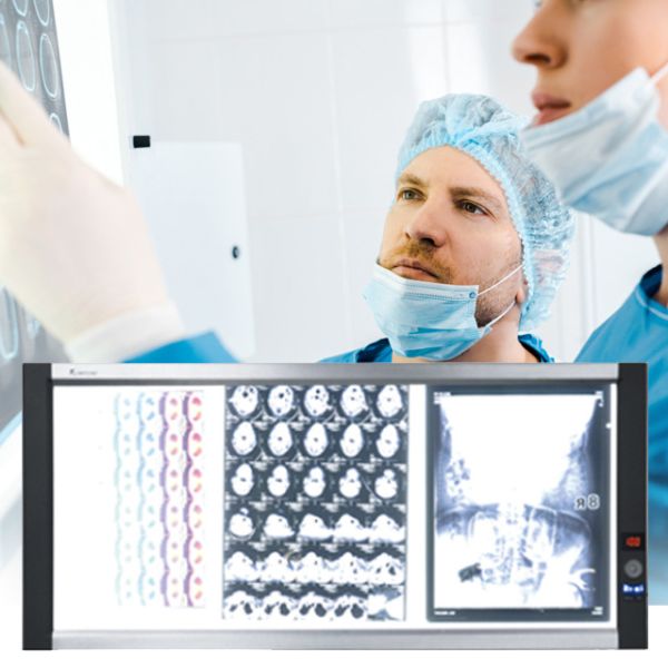 LED x-ray film viewerled medical film viewer