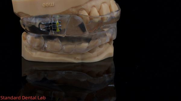 Appareils dentaires fonctionnels d' automne d' orthodontie du laboratoire dentaire chinois