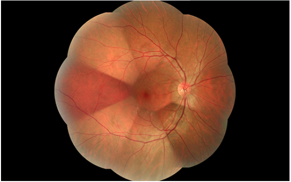 Ретинальная отображая система оборудования 13mm камеры изображений Fundus HD двойная