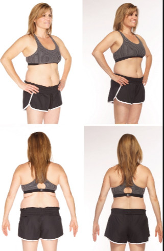 Safety Coolsculpting Slimming Beauty Machine For Fat Reduction / Body Contouring