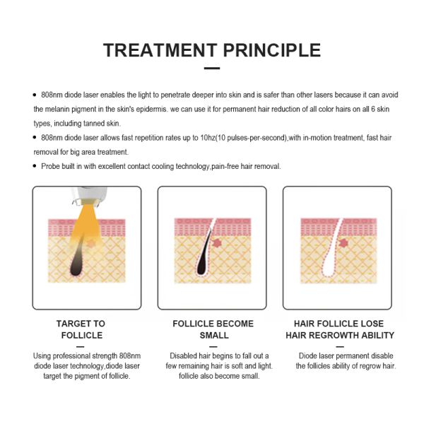 High Quality 755 810 1064 Intelligent Painless Titanium Upgrade Ice Laser Hair Device Diode Laser Hair Removal Epilation