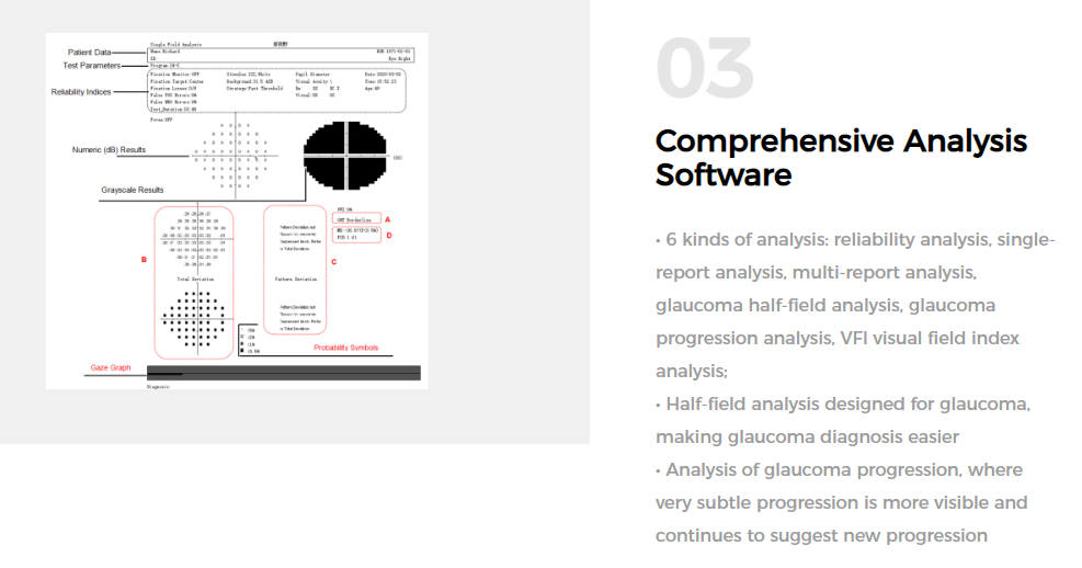 Больничная автоматизированная периметрия Goldmann III 240V 50Hz