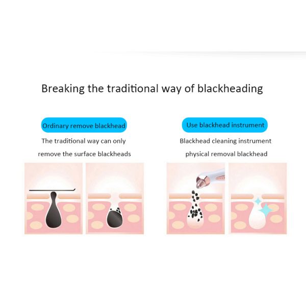 Eco Friendly Electric Blackhead Remover Tool Beauty Skin Acne Rejuvenation