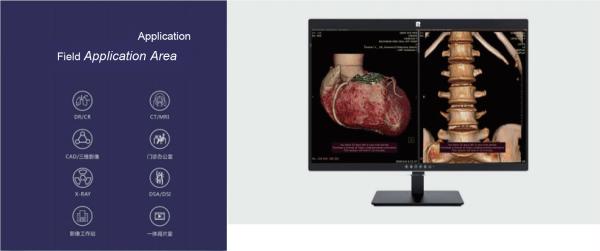 High-Definition Medical Monitor with DICOM Compliance and Precision Color Reproduction for Radiology Grade Imaging